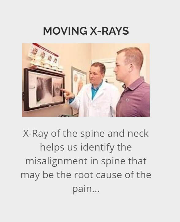 Moving X ray help to find root cause in Lincoln